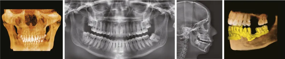 Vatech Green X12 система рентгеновской визуализации 4-в-1 КТ панорама цефалостат сканер моделей