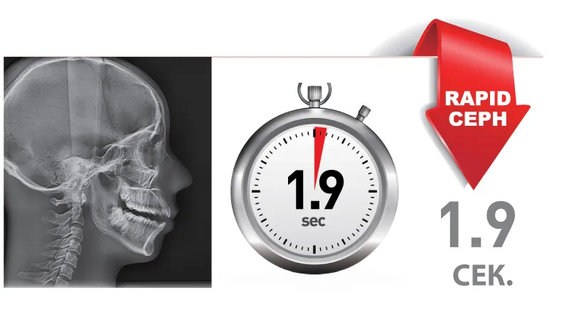 RAPID CEPH технология минимизации артефактов движения при цефалометрическом сканировании