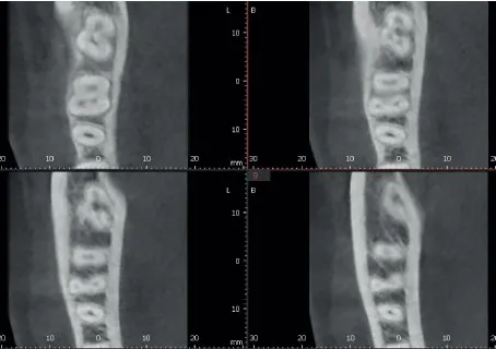 Обычный режим сканирования КЛКТ для сравнения