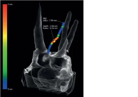 Эндо режим детализация корневых каналов 49.5 мкм