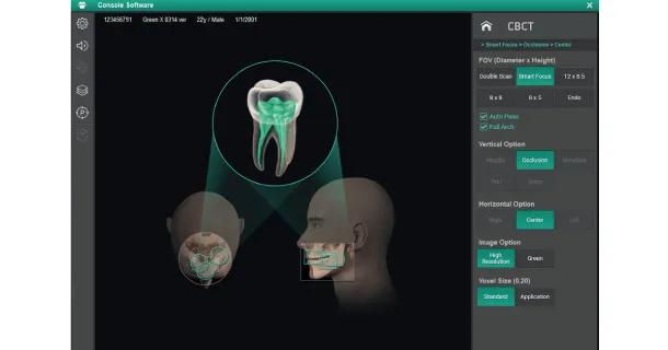 Smart Focus технология - захват 5 изображений за одно сканирование