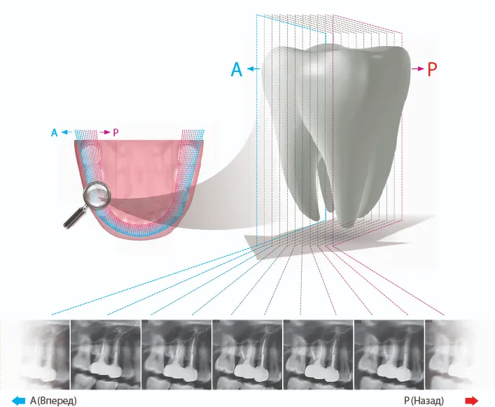 Insight технология многослойных панорамных изображений