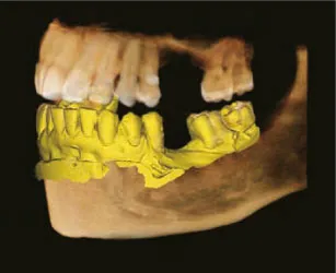 Интеграция с CAD/CAM системами через 3D сканирование моделей